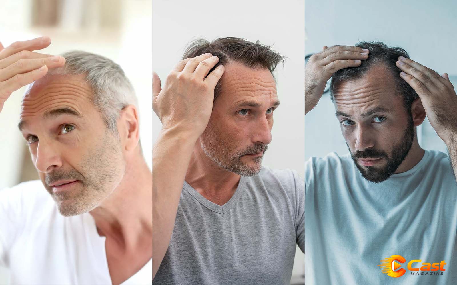 Hair Thinning